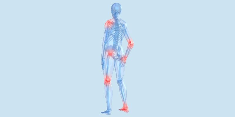 A skeleton of a person with red spots on their joints.