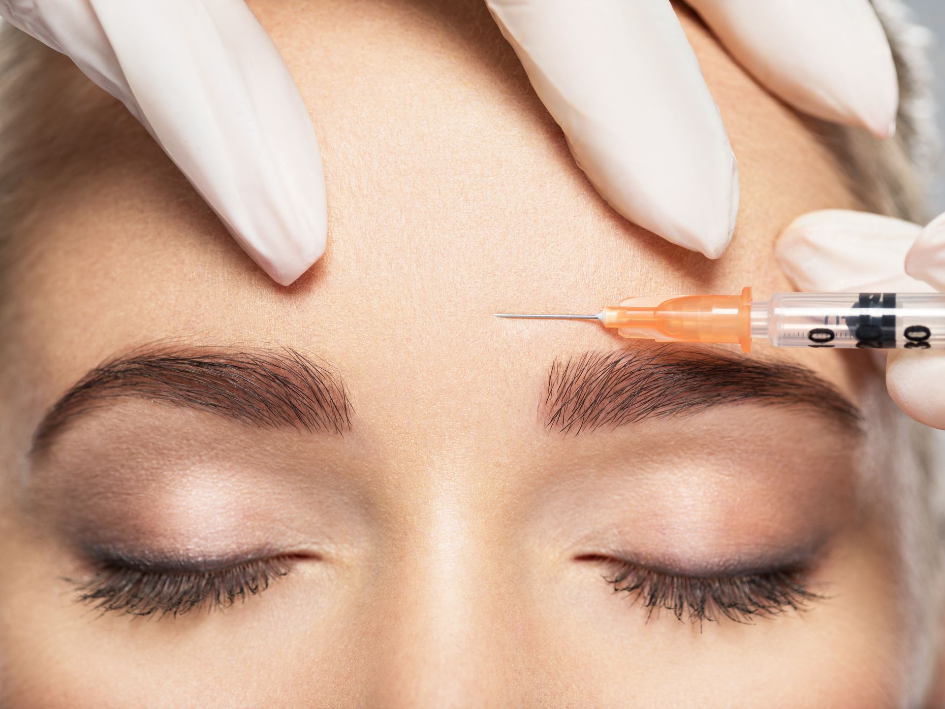 Botox injection being administered to forehead to reduce facial wrinkles.