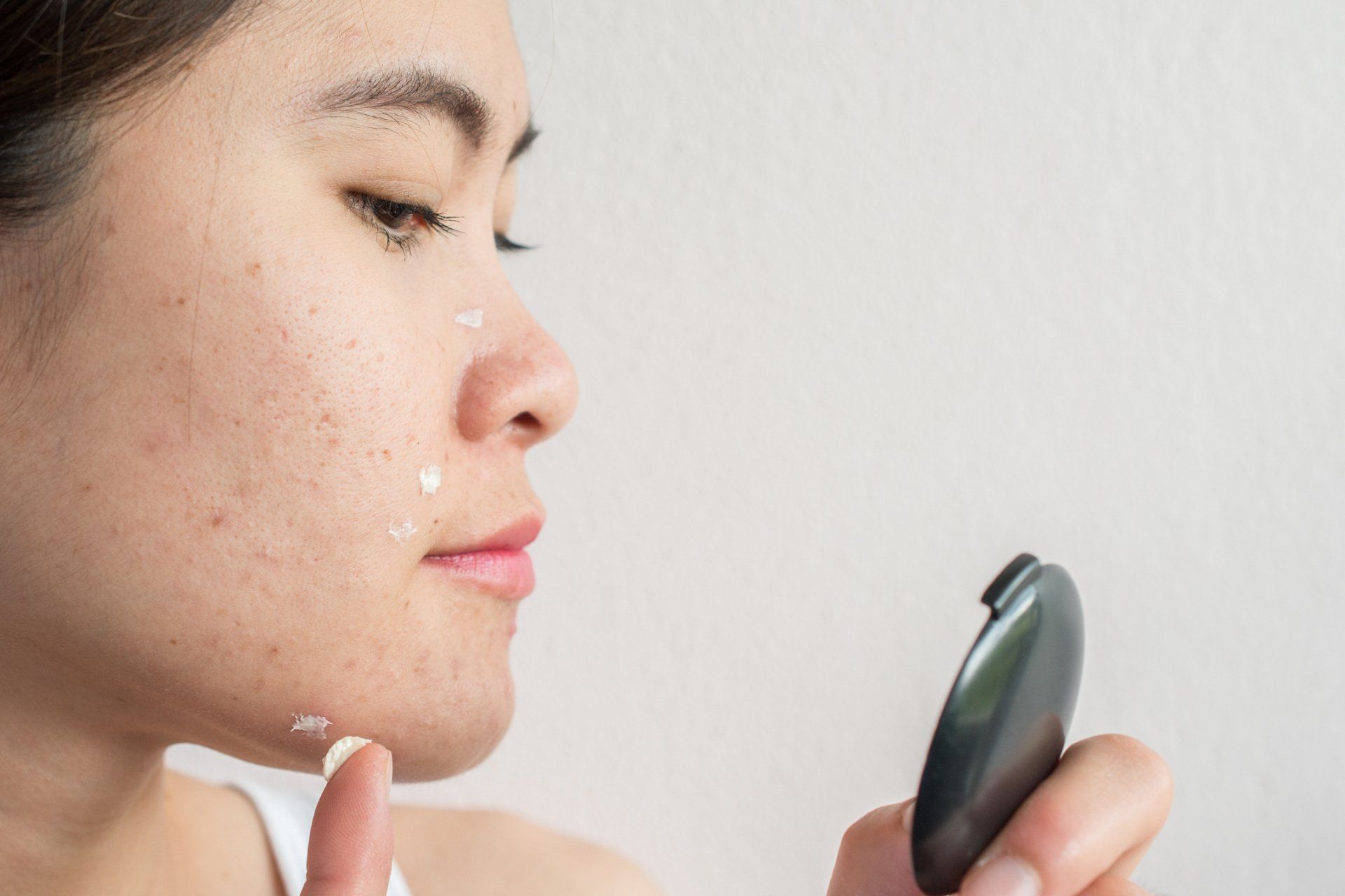 Woman applying cream to face, looking into a compact mirror with acne.