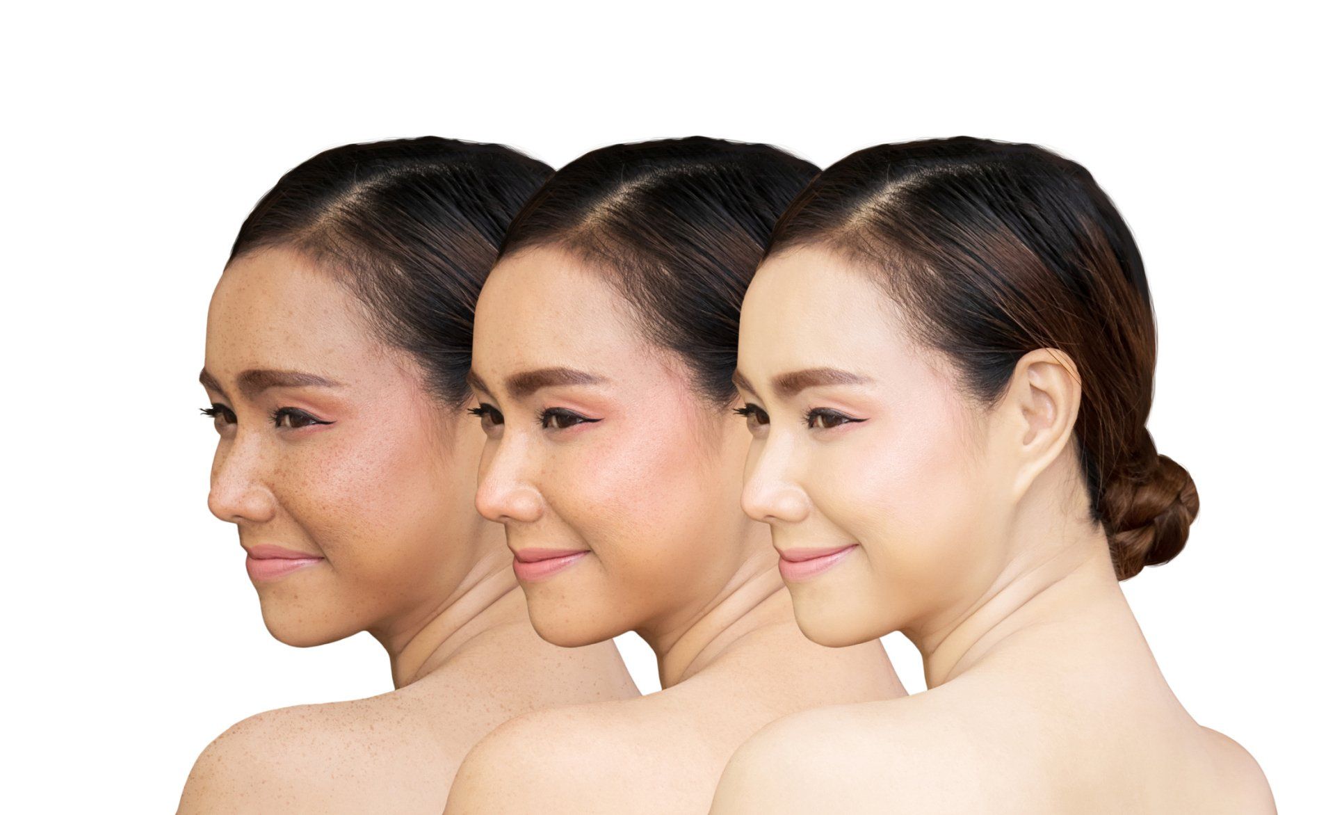 Three profile views of a person's face showing skin tone improvement. The first has spots; the last is flawless.