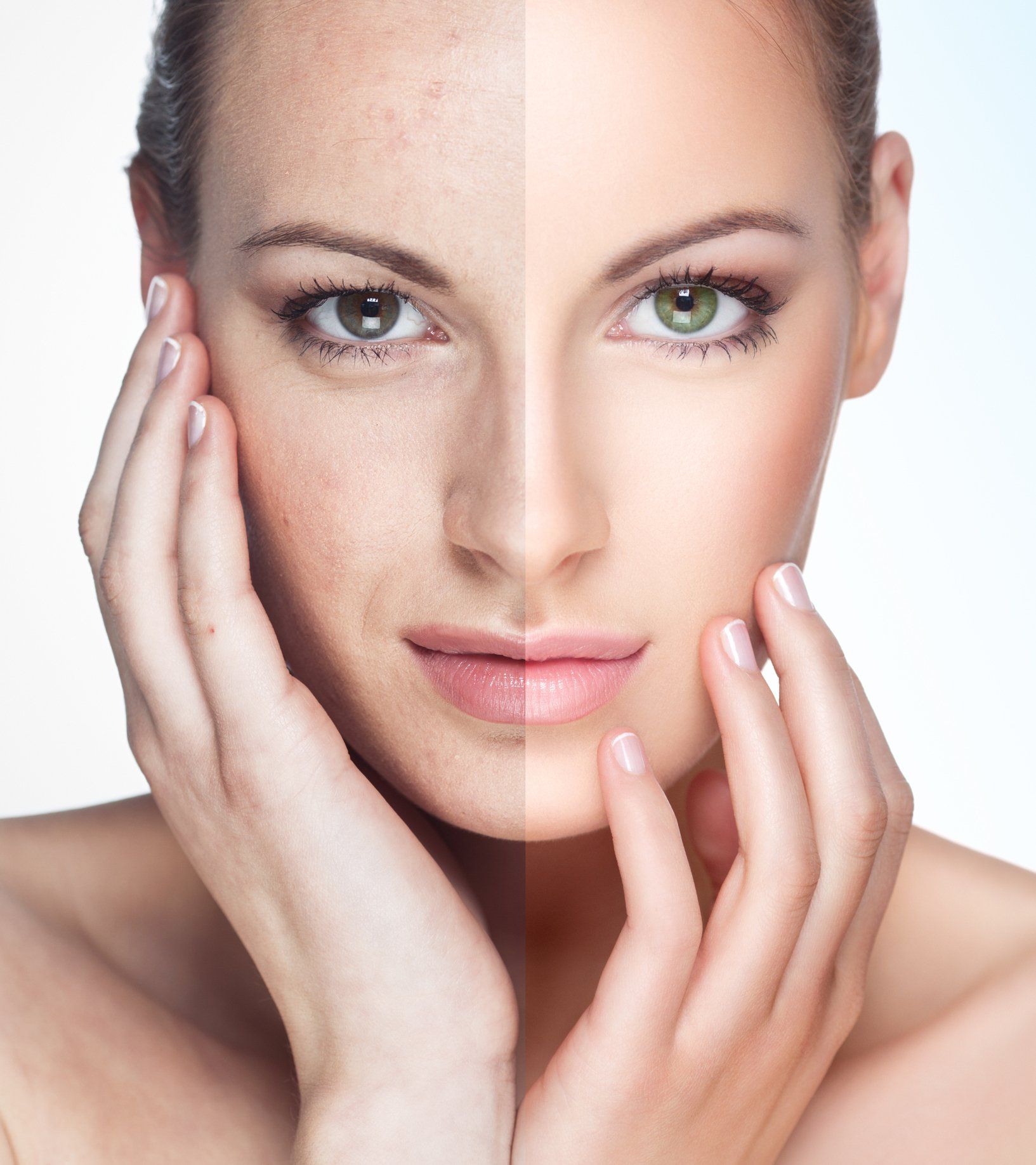 Woman's face split: left side with blemishes, right side with smooth, clear skin; hands framing face.
