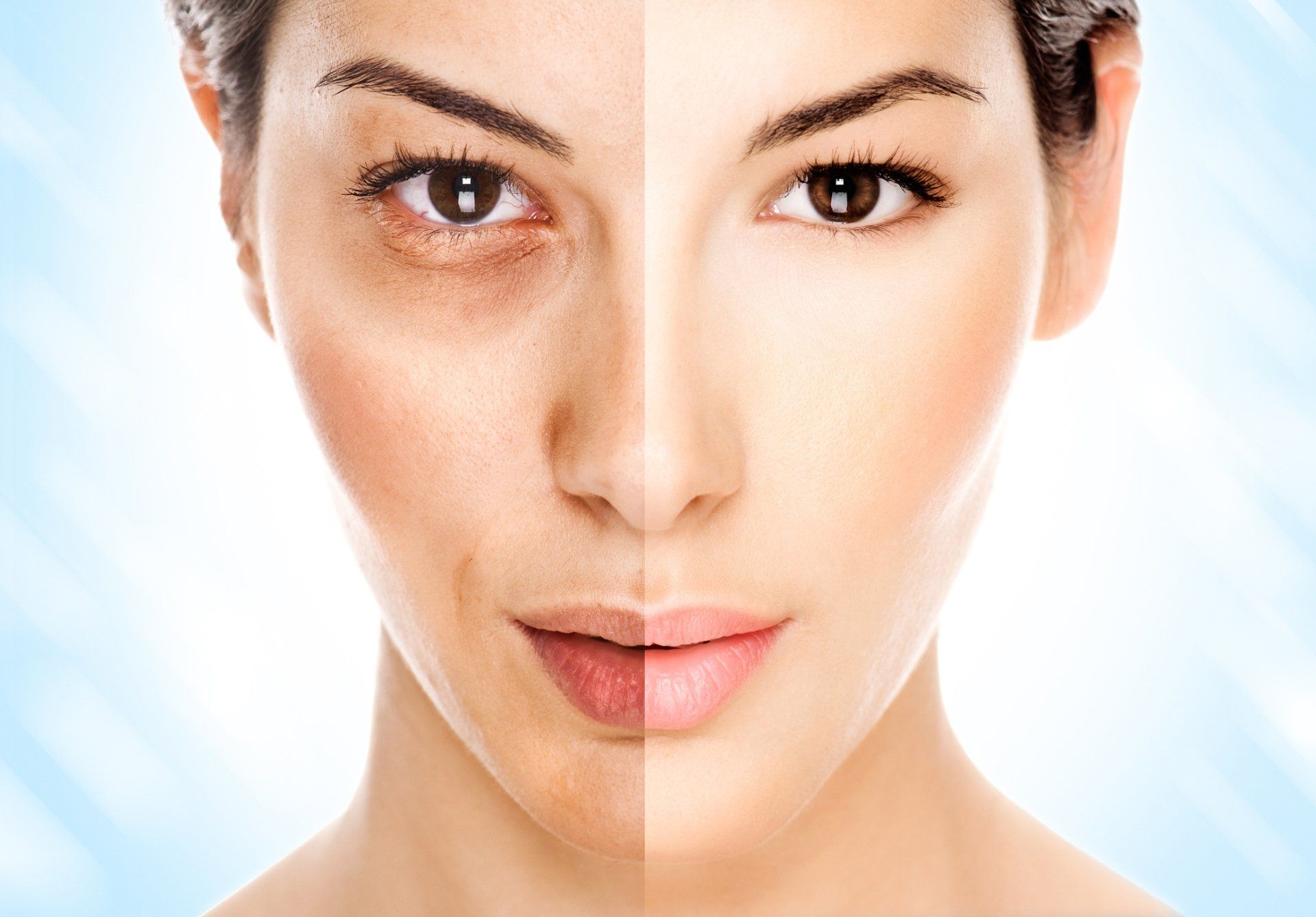 Woman's face split in two: left side with dark circles, right side smooth and bright.