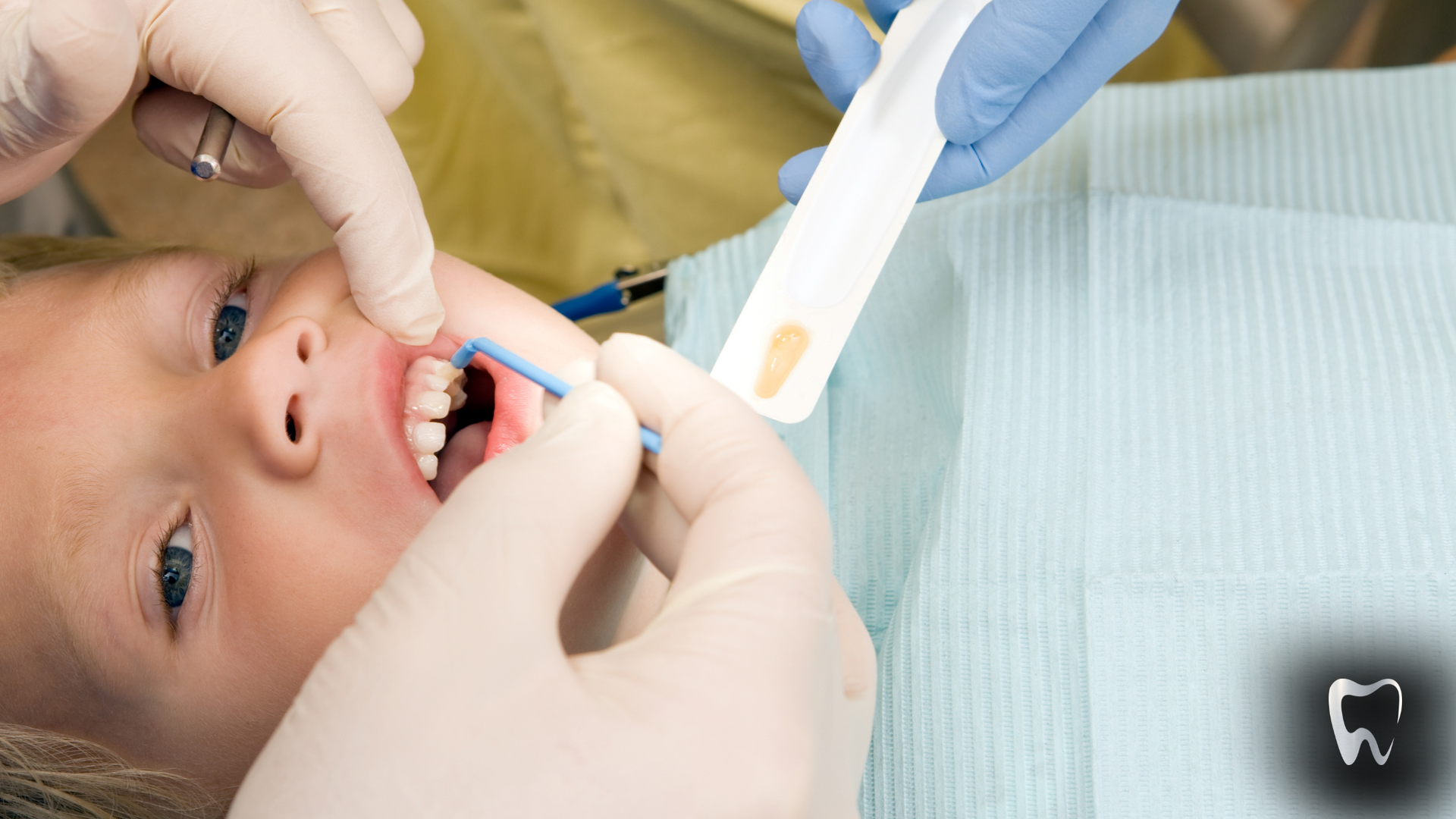 A child is getting his teeth examined by a dentist.