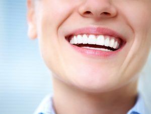 A close up of a woman 's smile with white teeth.