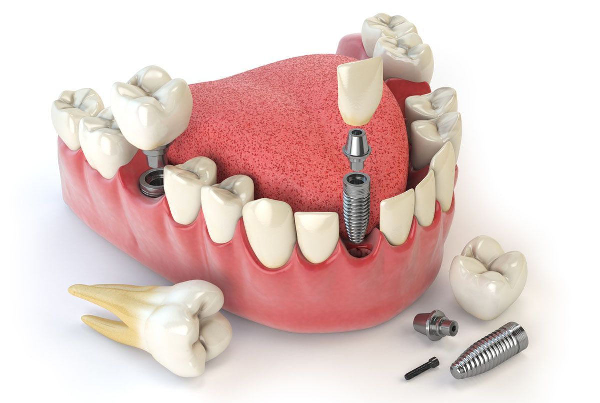 A woman is getting her teeth examined by a dentist.