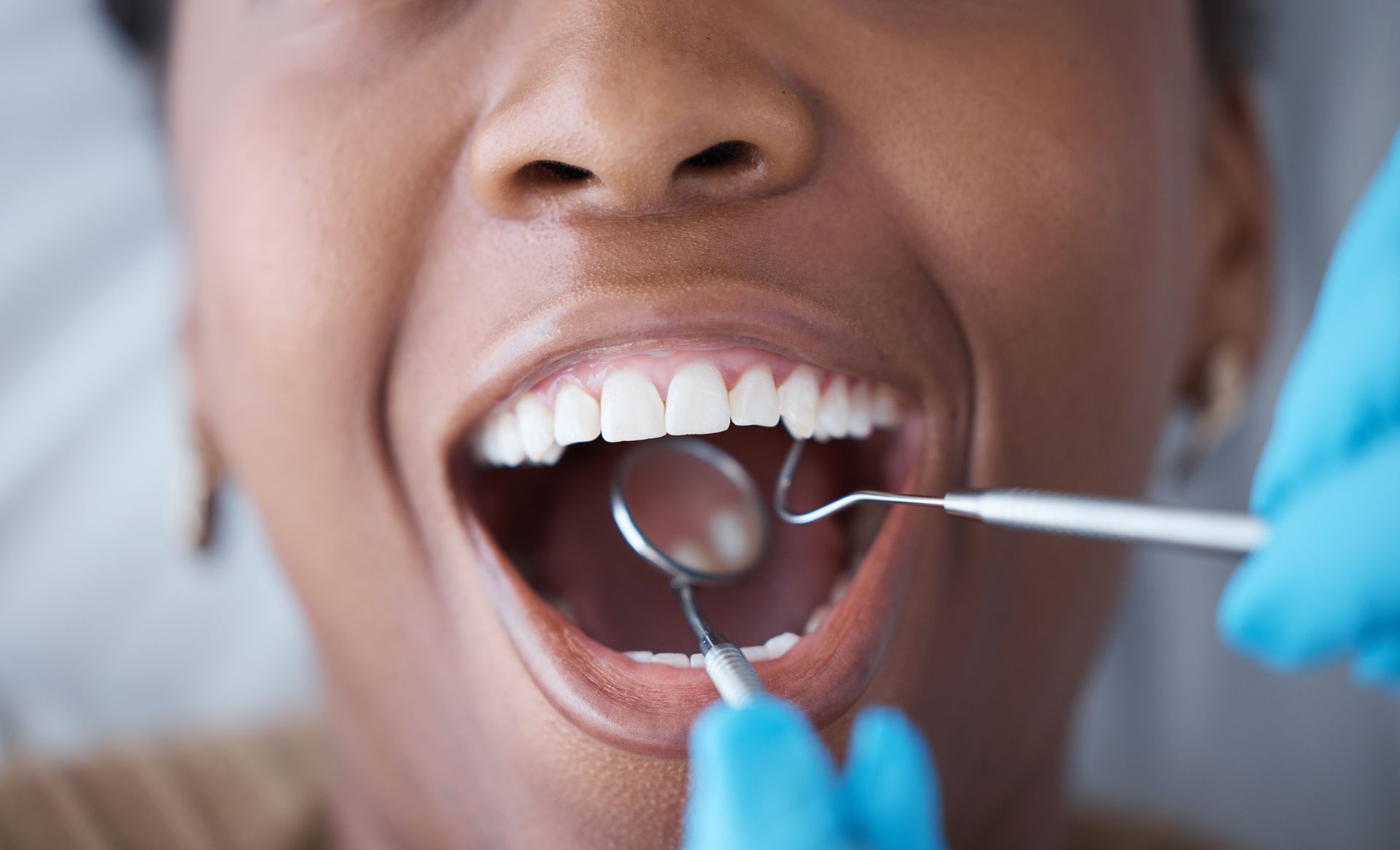 Dental professional examining a patient's teeth with a mirror and dental tool.