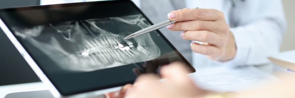 radiografia dentale