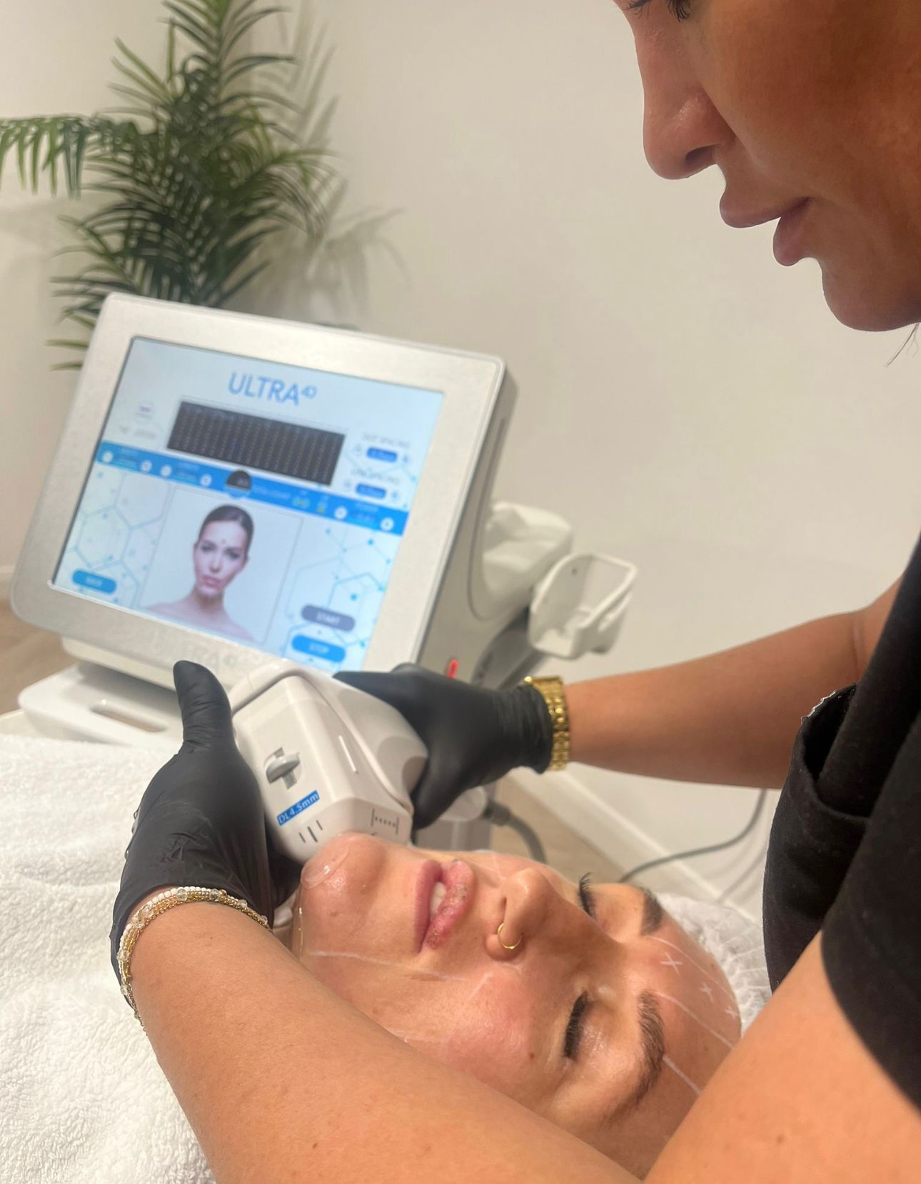 A practitioner in black gloves uses an ultrasound device on a client's jawline during a cosmetic procedure.