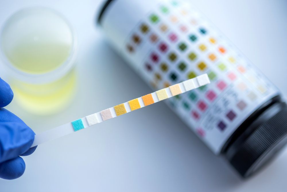 A Person in Blue Gloves Holding a Urine Test Strip — DAB Services in Cannonvale, QLD