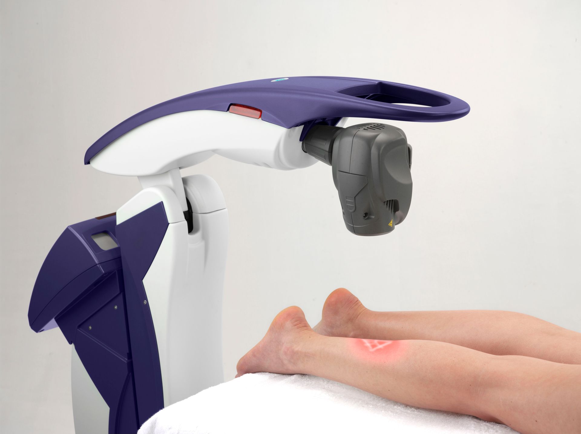 Medical device treating leg with red laser. Purple and white device over patient's legs on a bed.