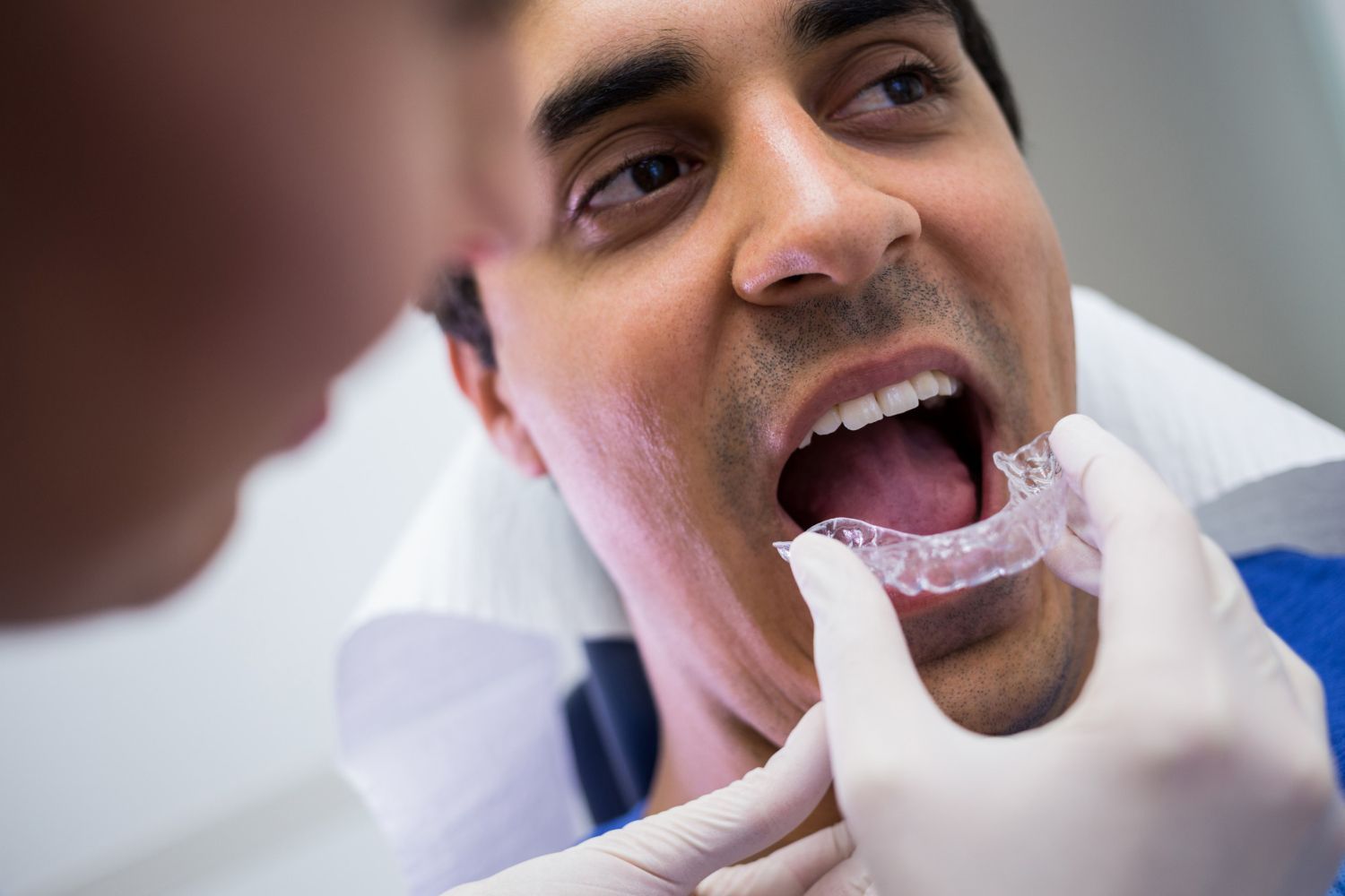 How Much Are Invisalign Retainers? Vivera Cost Guide