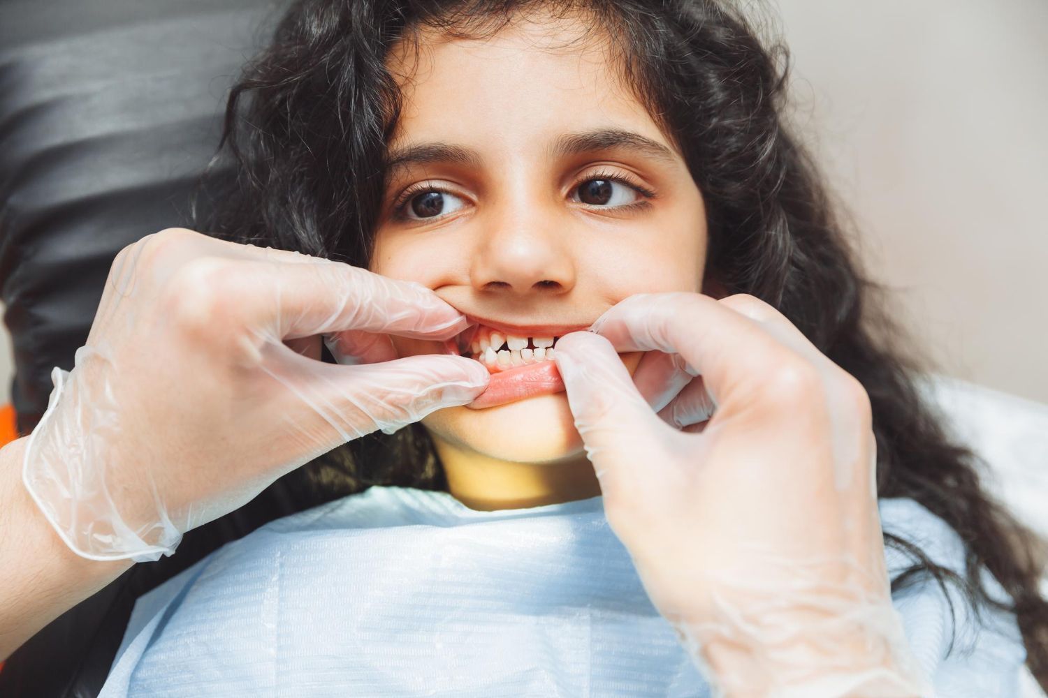 How to Replace Missing Teeth
