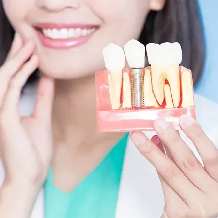 Teeth model demonstration