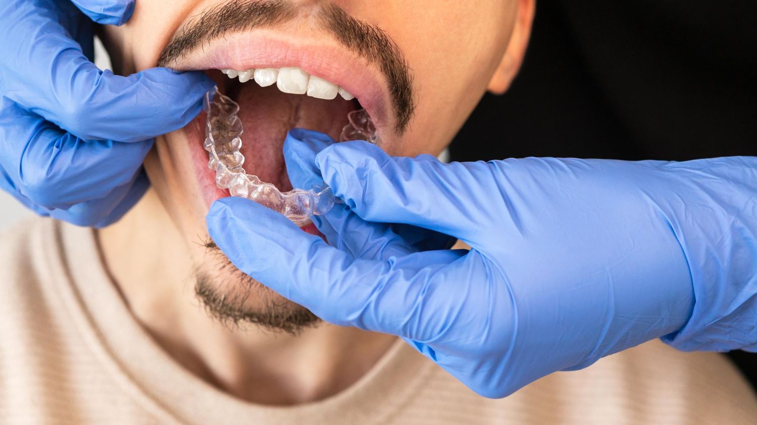 is-invisalign-faster-than-braces
