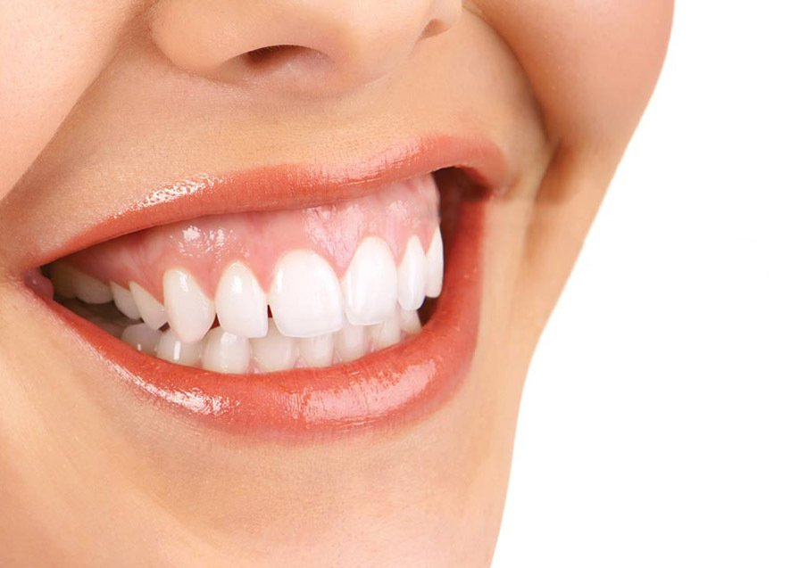 Smiling patient