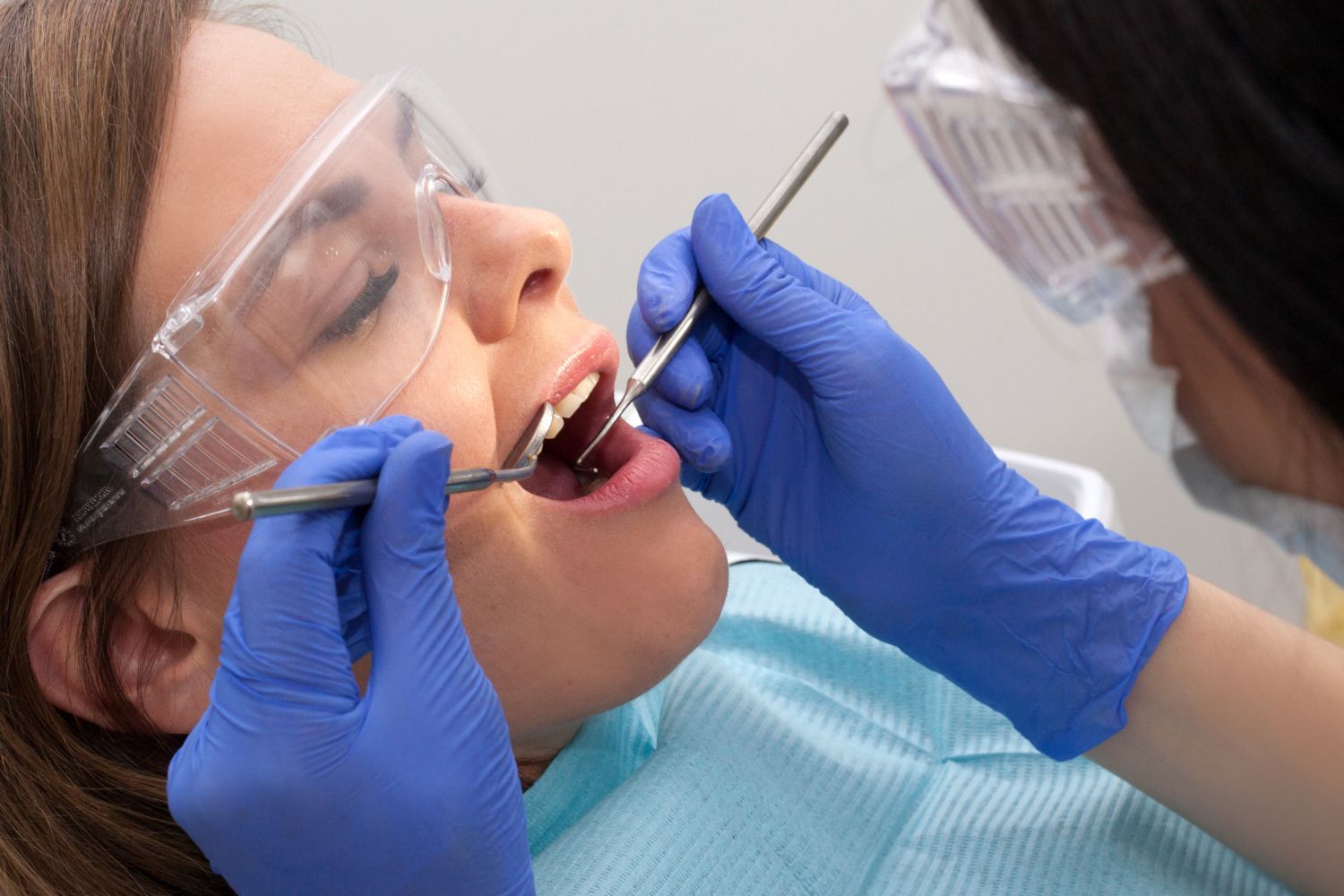 What Are Dental Fillings?