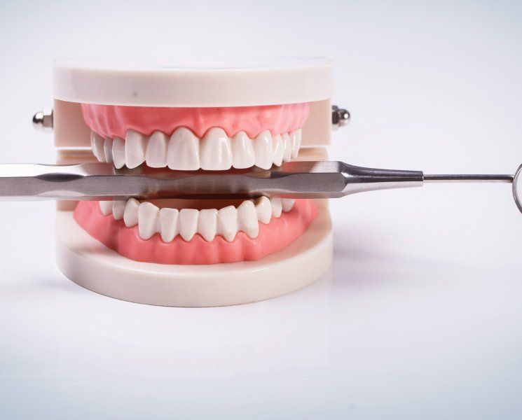 Teeth model