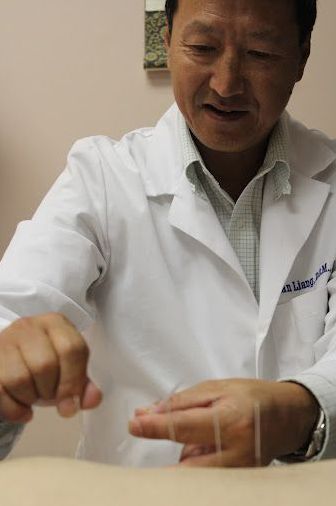 Woman With Acupuncture Needles On Her Back — Sarasota, FL — Center For Acupuncture And Oriental Medicine