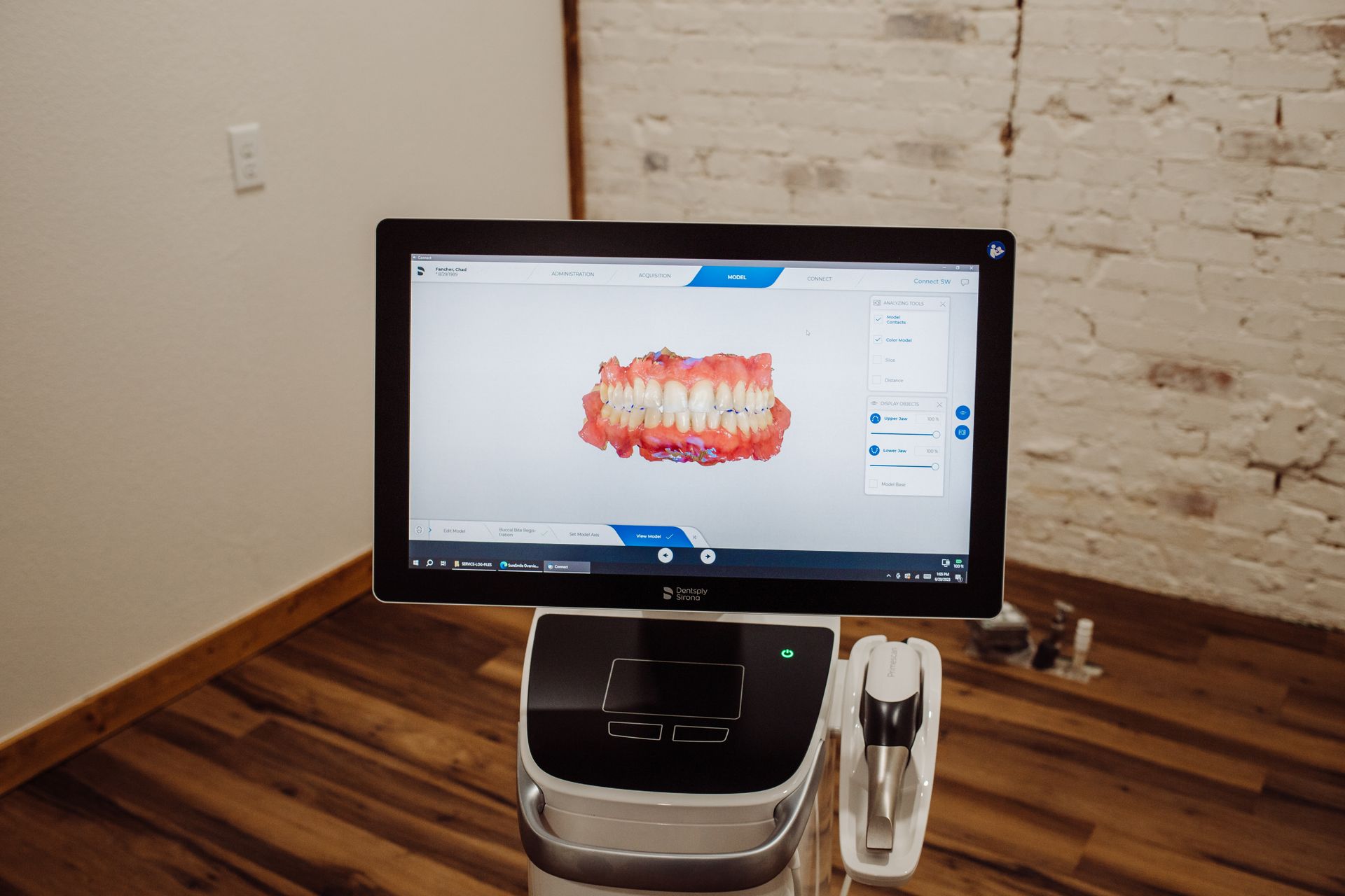 Dental scanner displaying a 3D model of teeth in a dental office.