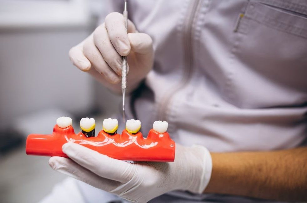 Dentist holding a model of teeth, using a dental tool. White gloves, red base, teeth are yellow/white.