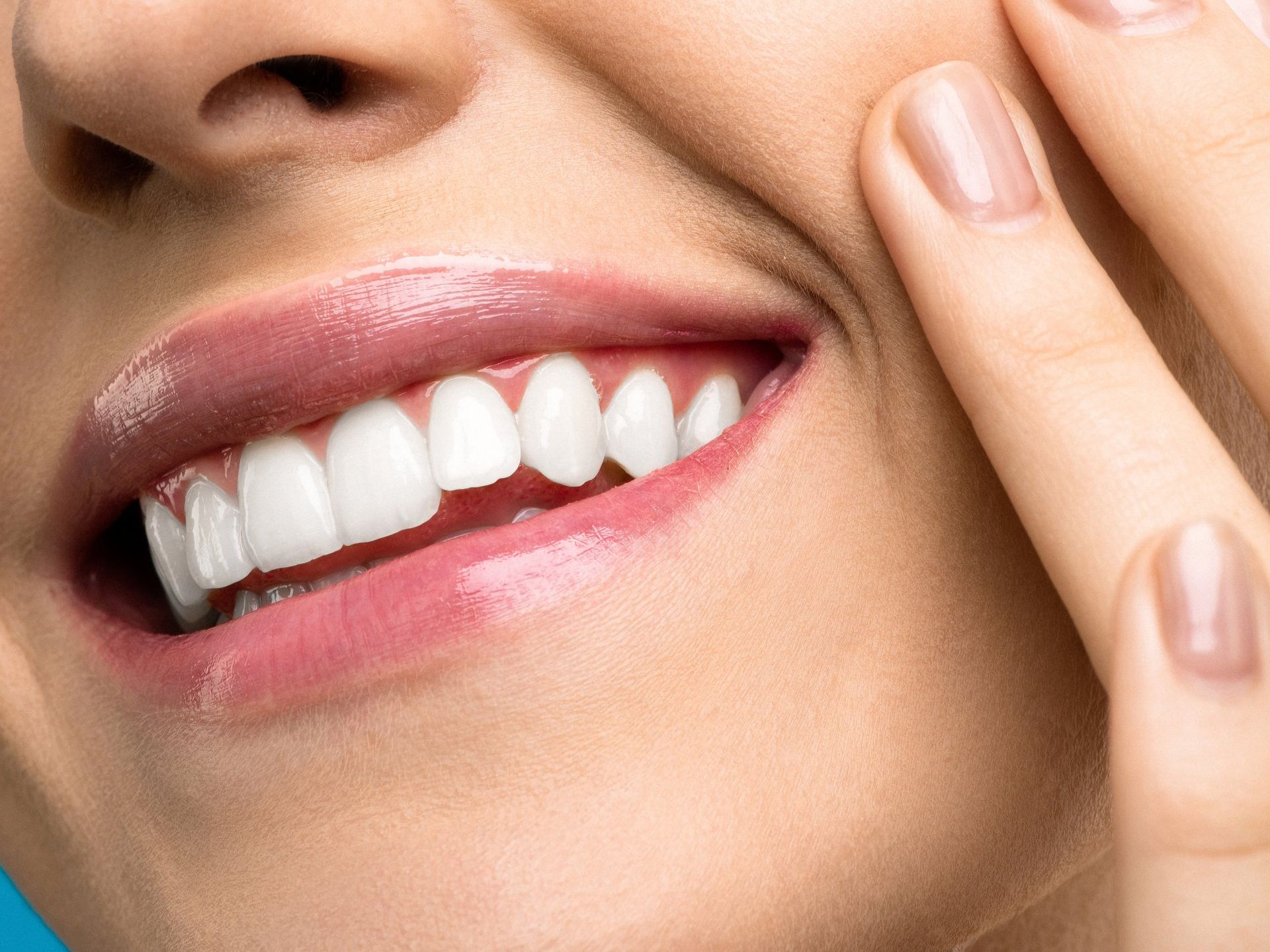 Porcelain veneers