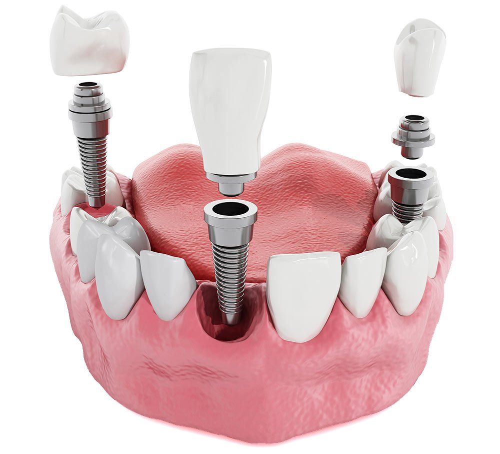 Dentist Oakdale