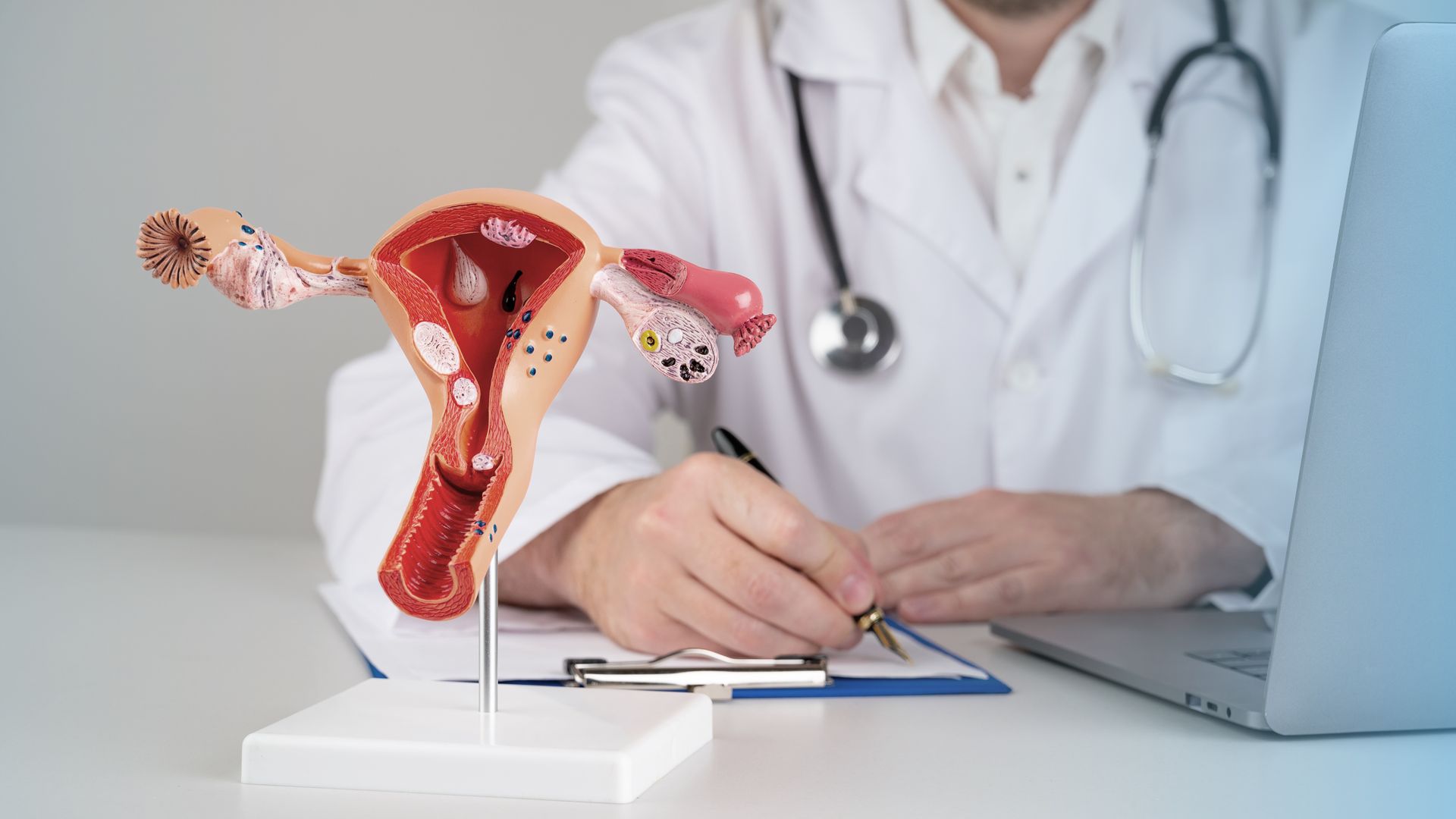 Medical consultation featuring a detailed female reproductive anatomy model and paperwork.