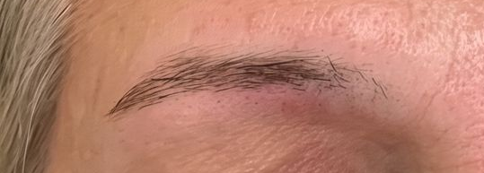 Close-up of an eyebrow and upper eyelid with a small dark mark on the skin