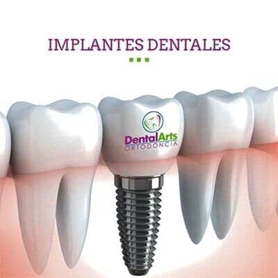 DENTAL ARTS