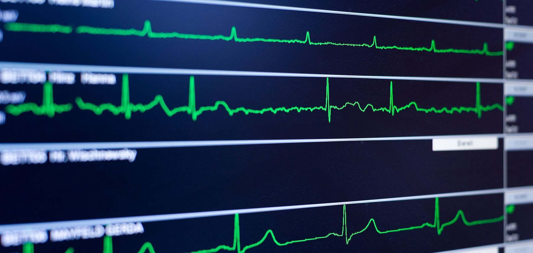 Hospital monitor with green heart rate traces on dark screens