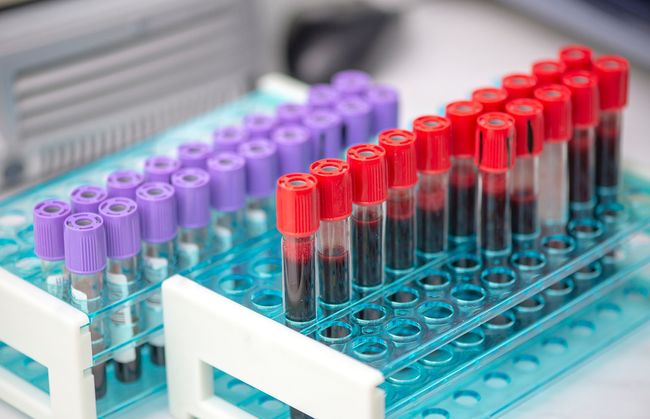 MUESTRAS DE LABORATORIO