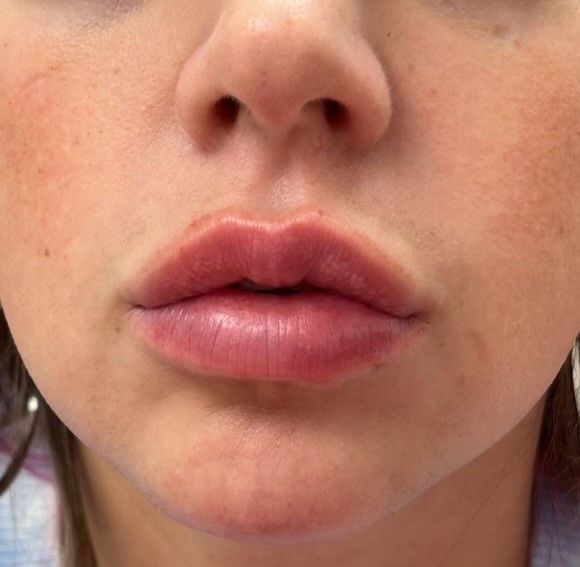A close up of a woman 's lips and nose