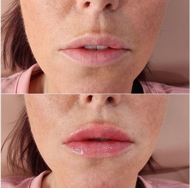A before and after photo of a woman 's face