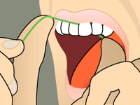 Tweezers removing a green dental floss thread from between front teeth and tongue
