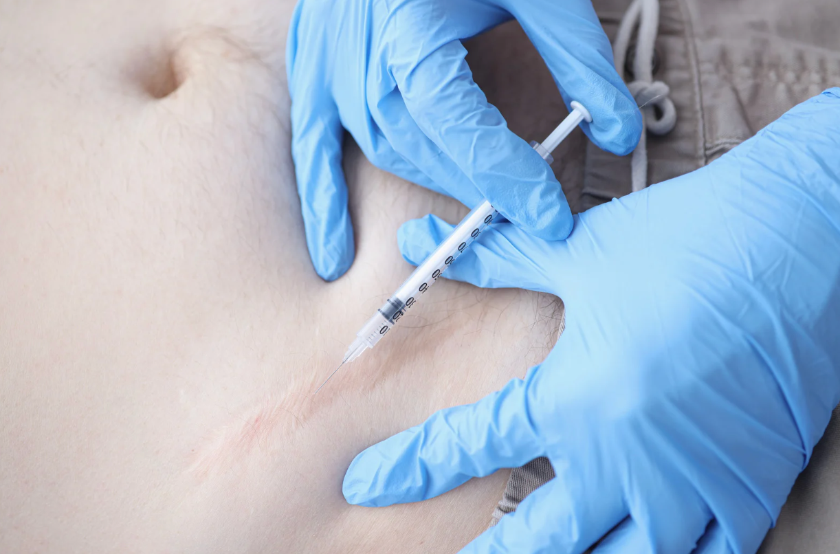 Person receiving an abdominal injection by gloved hands; syringe entering skin.