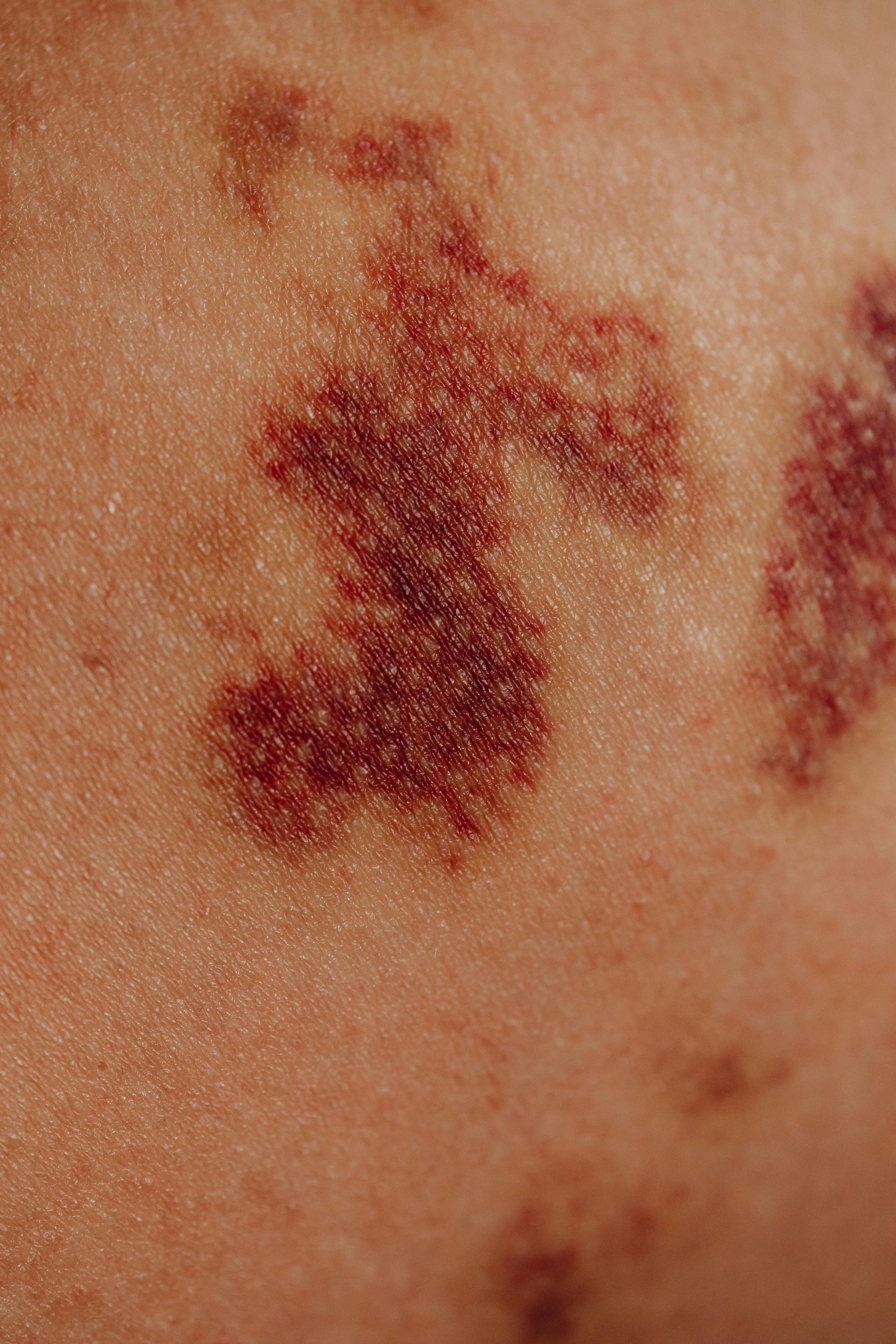 Close-up of arm with armpit hair; a hand is touching the arm.