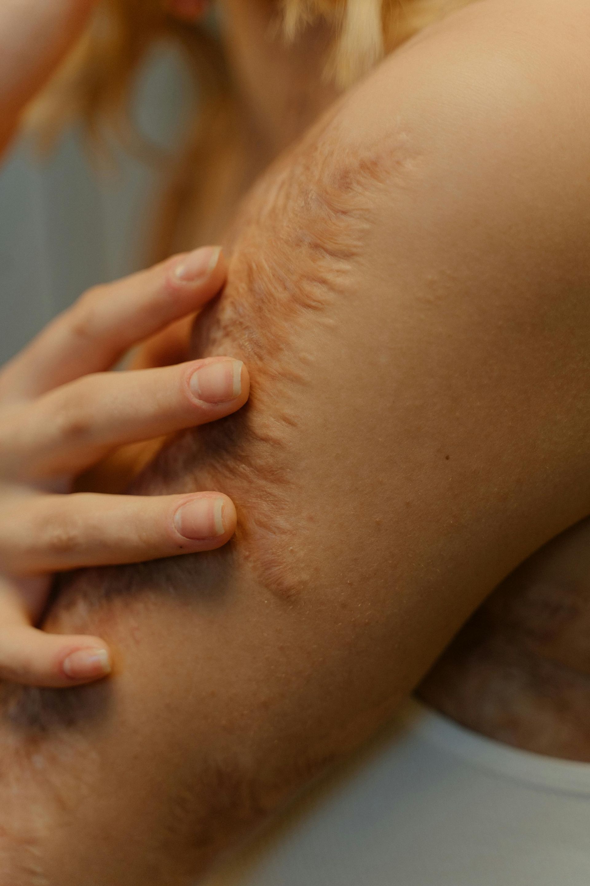 Close-up of arm with armpit hair; a hand is touching the arm.