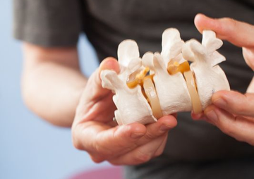 Hands holding a white model of the lower spine with orange spinal nerves.