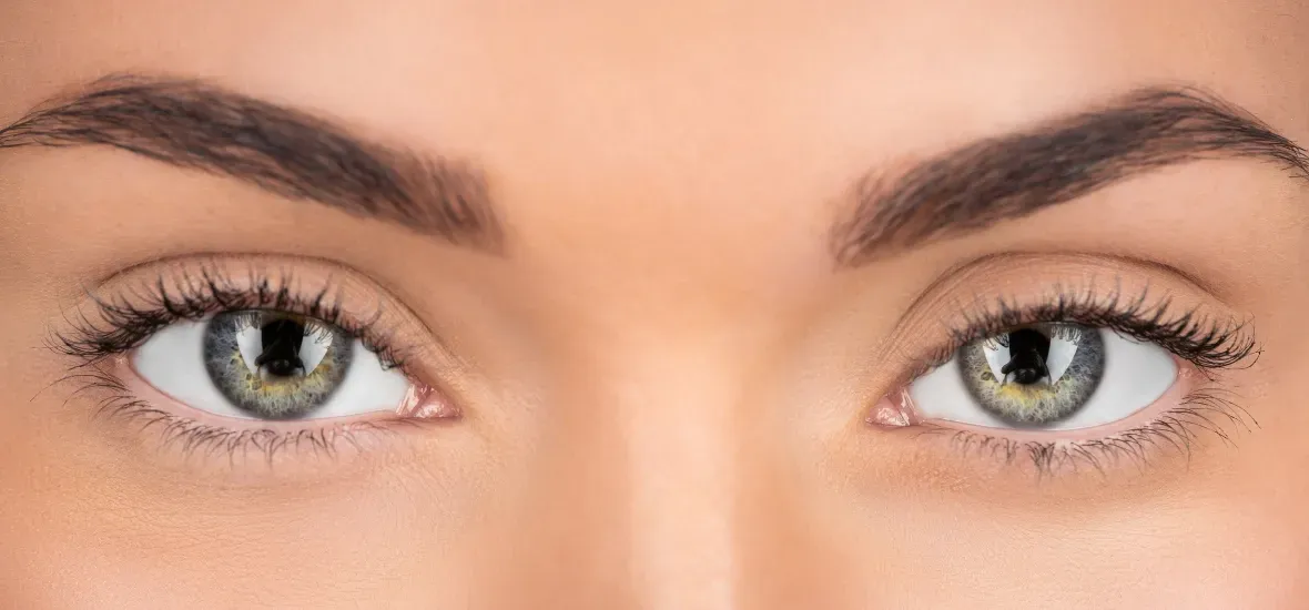 Woman smiling, after under eye tear trough filler at the best medspa in miami Moncao MedSpa