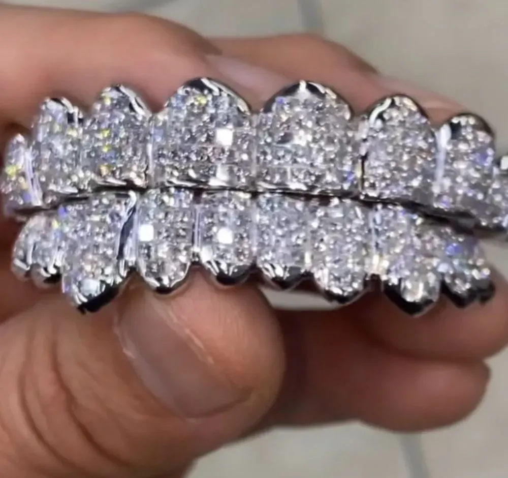 A diamond-studded grillz