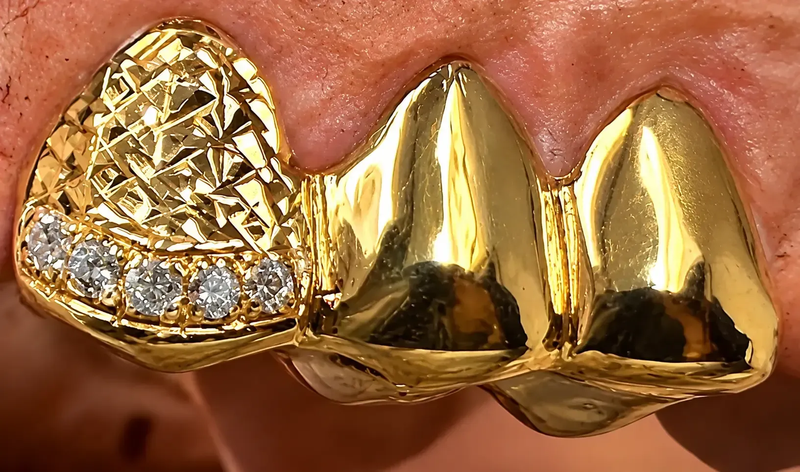 Diamond-encrusted silver custom grillz held in hand