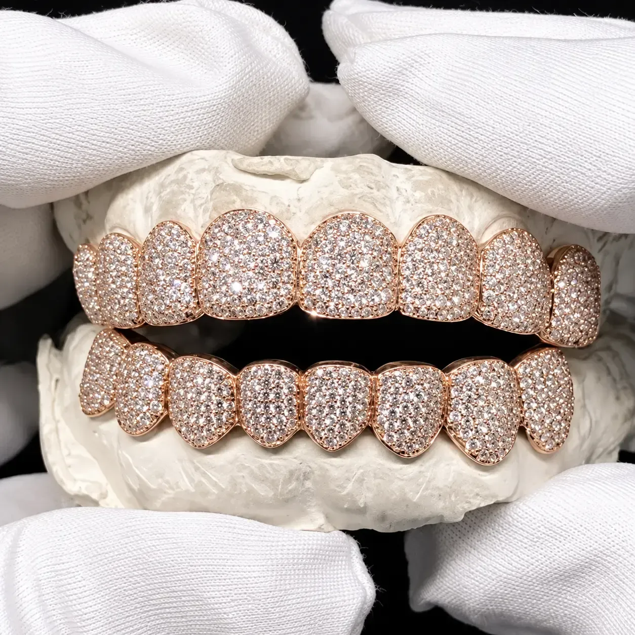 custom diamond grillz