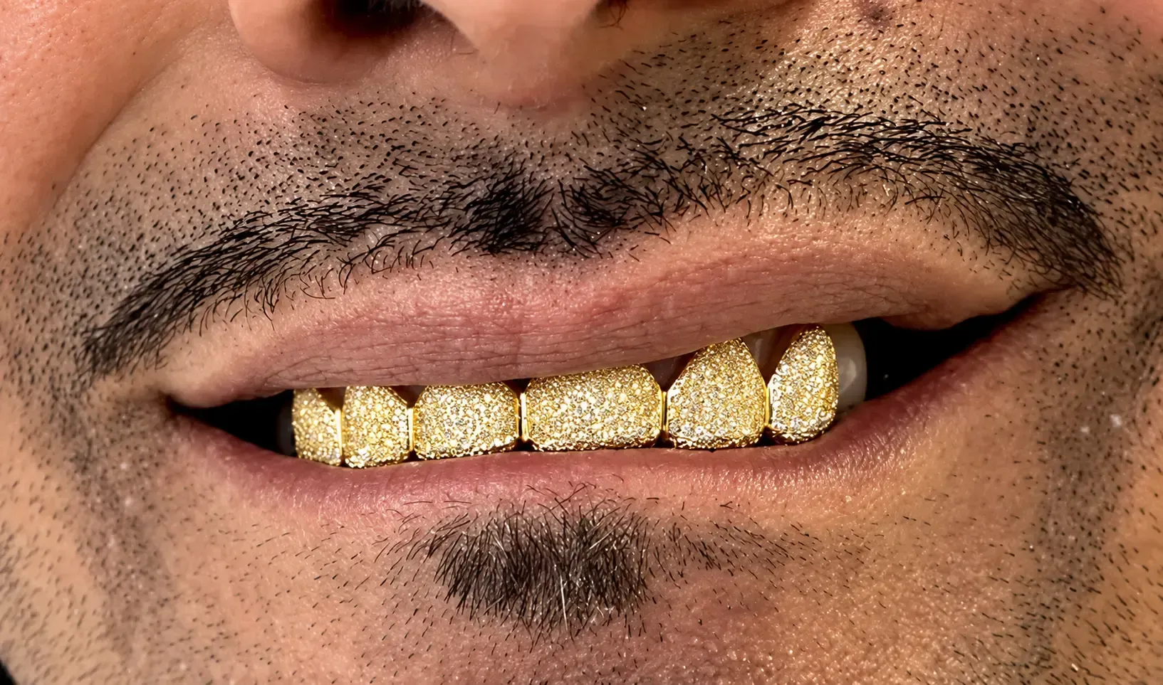 gold grill