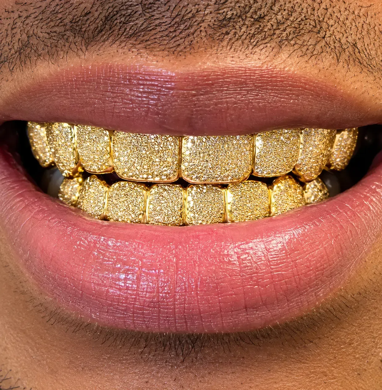 gold grillz