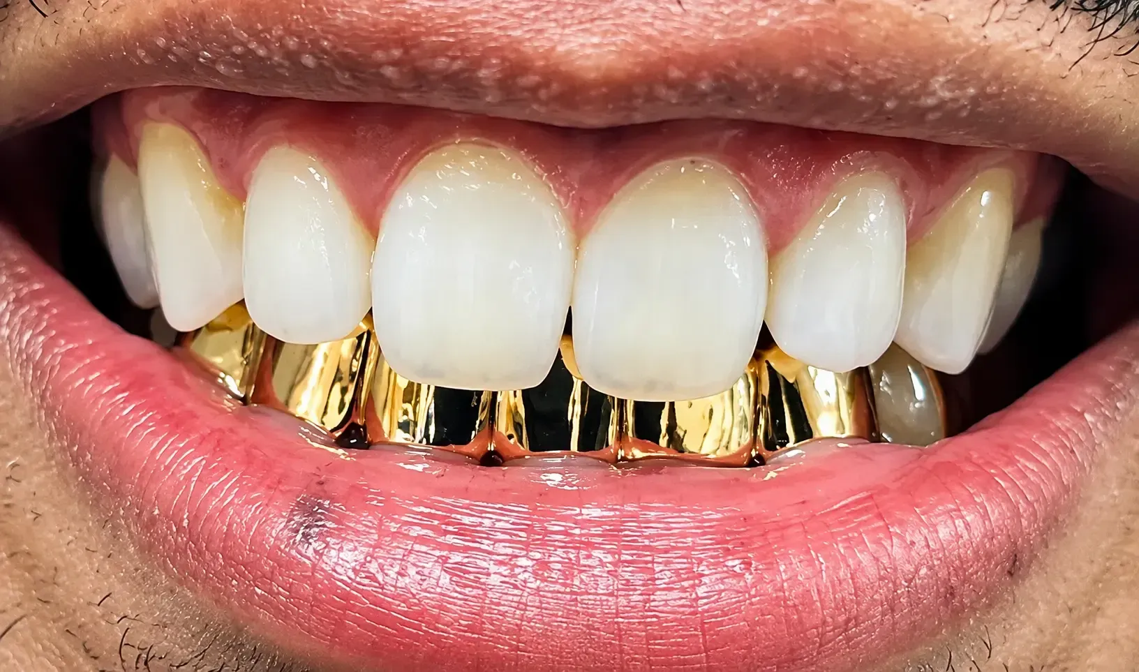 A smiling mouth with white teeth and permanent gold grillz on the lower front teeth from Grill Cheese Grillz