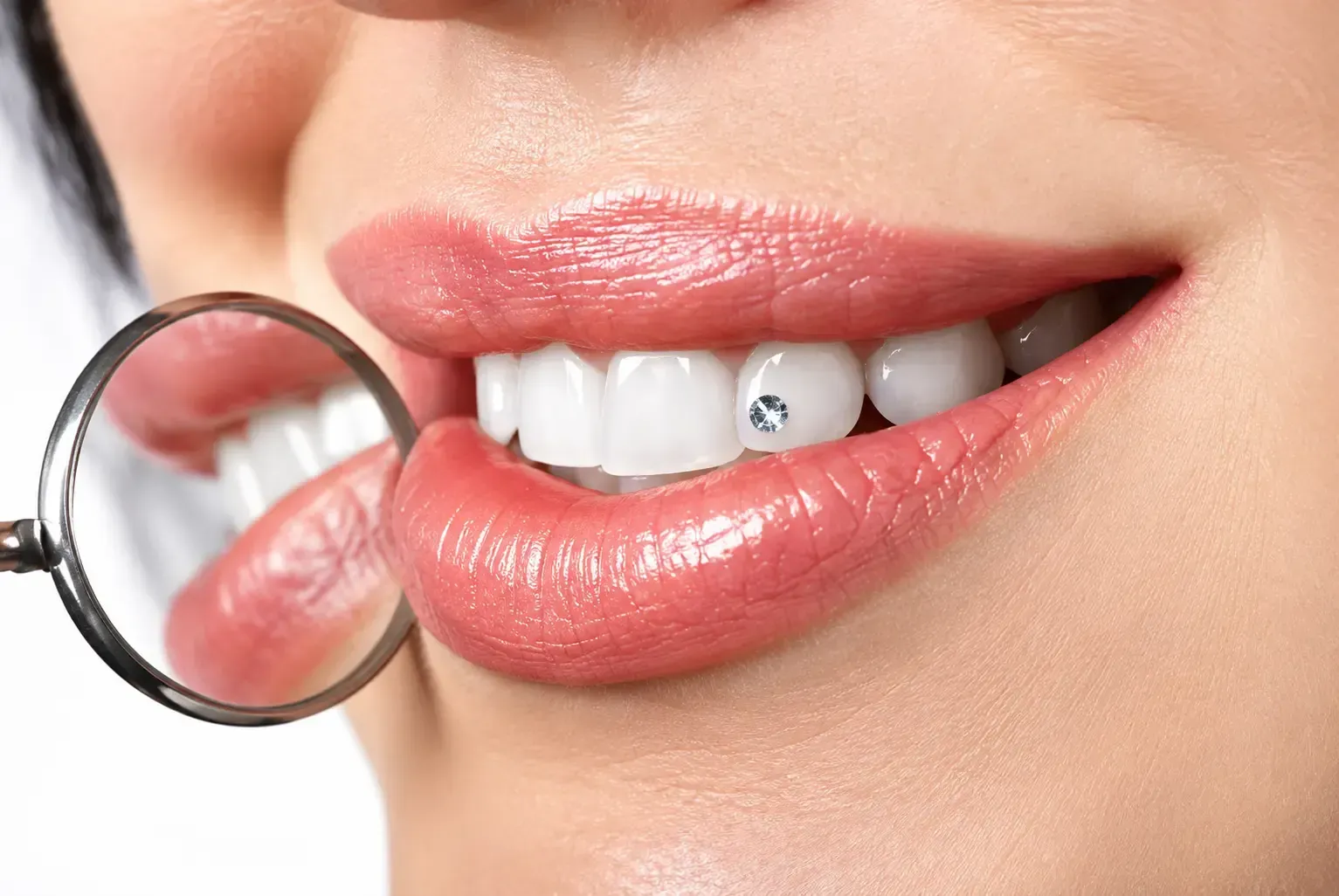 clear tooth gem