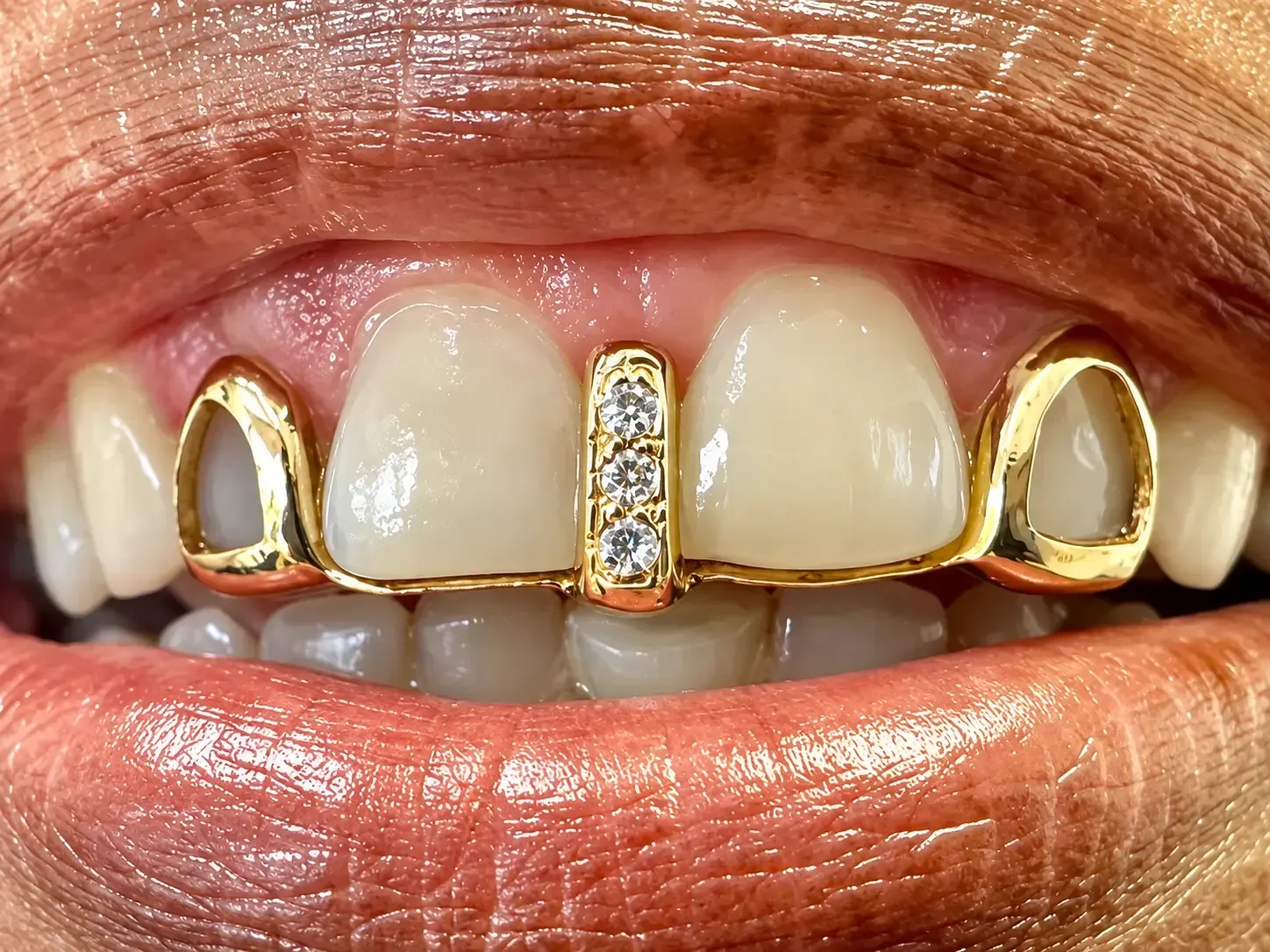 gold grill with diamond