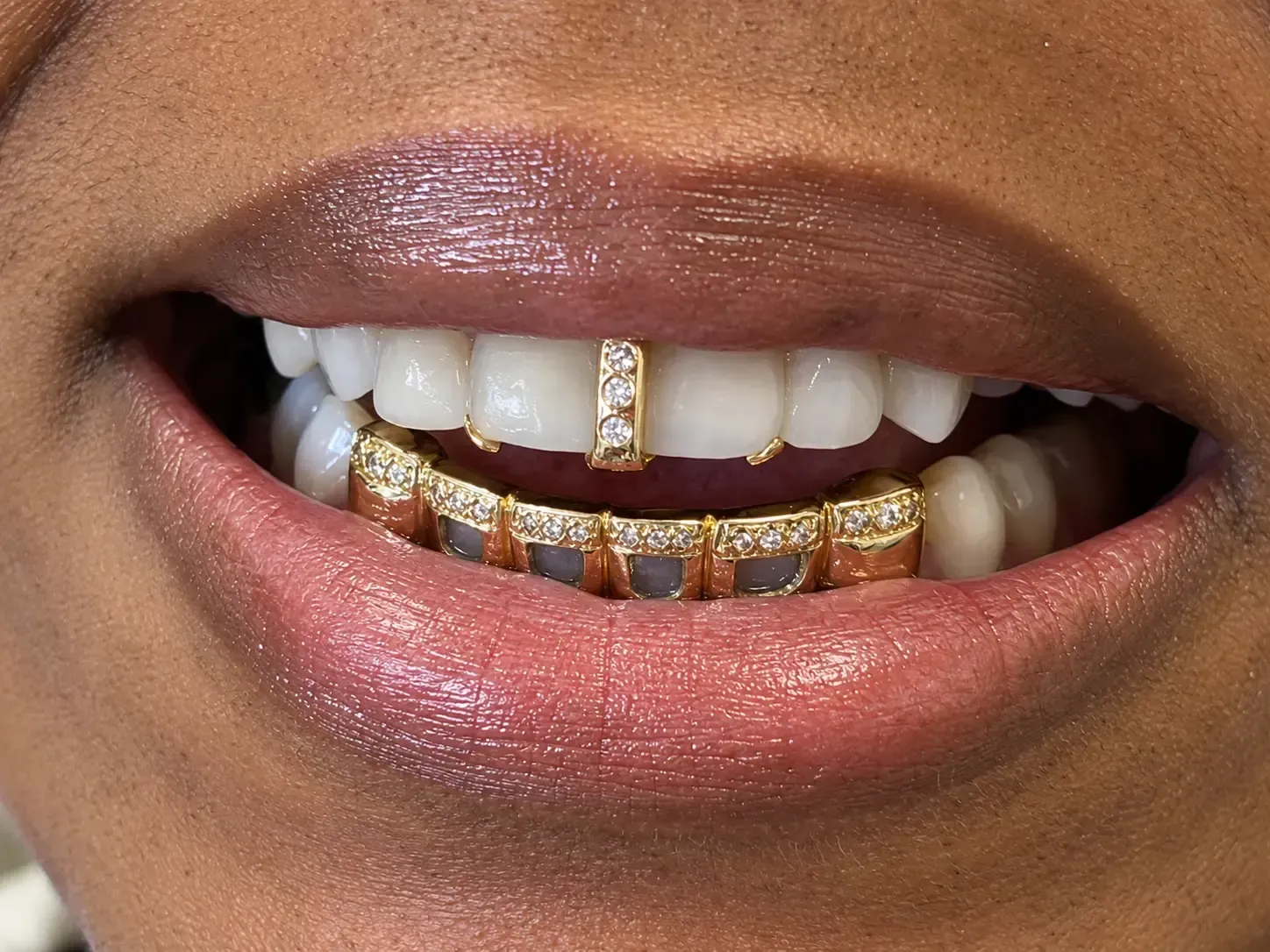 special custom gold grill with diamonds