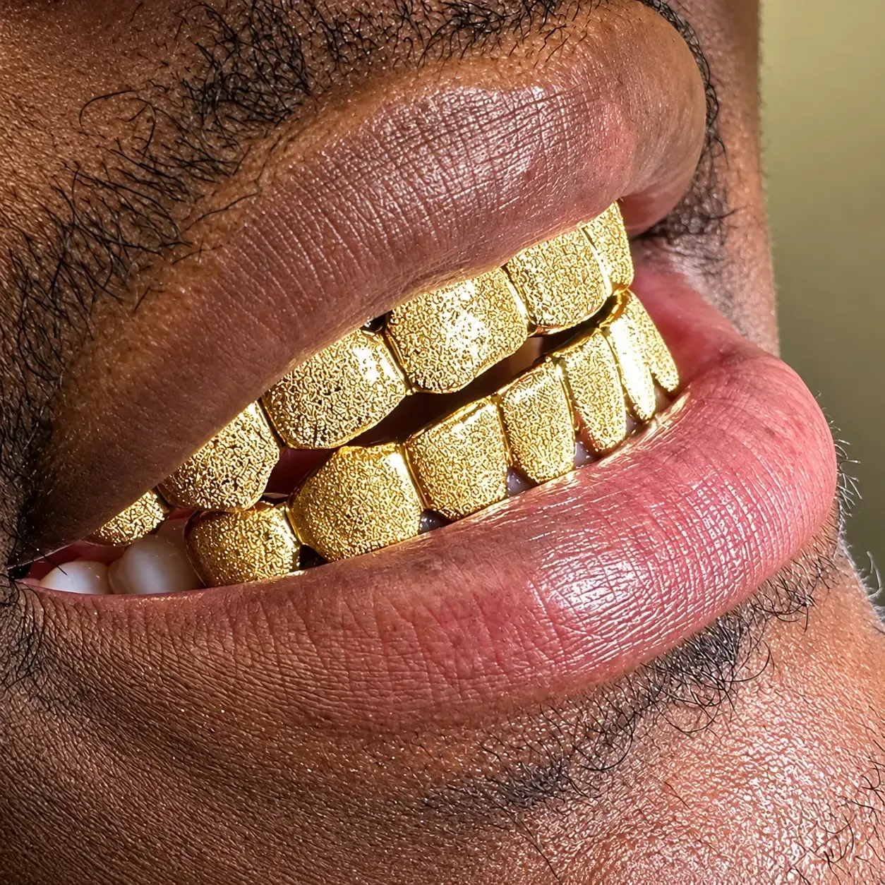 permanent gold teeth