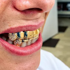 Gold top grill 